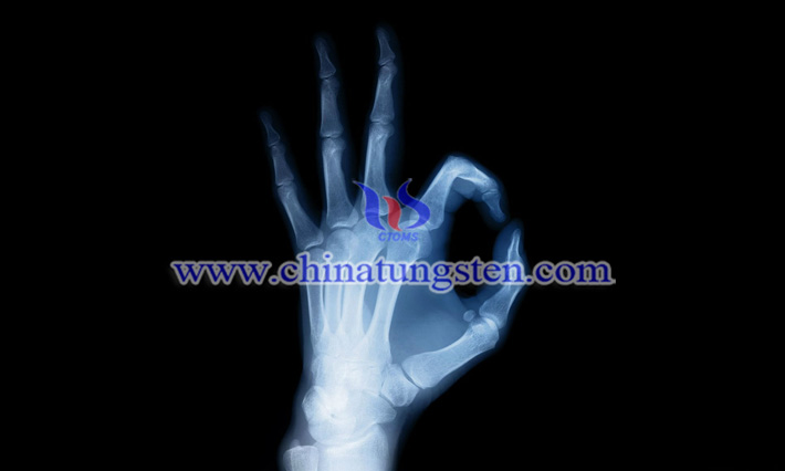 X線(xiàn)シールドタングステン含有複合フィルム