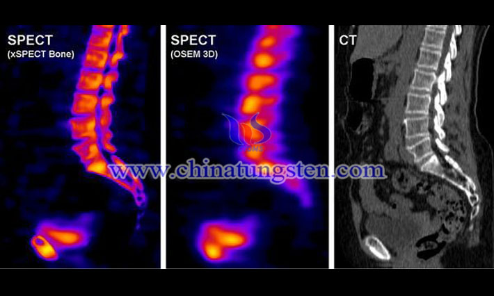 タングステン重合體コリメータ畫(huà)像